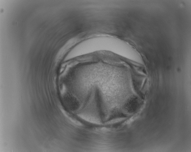 X0000075900197200610151824