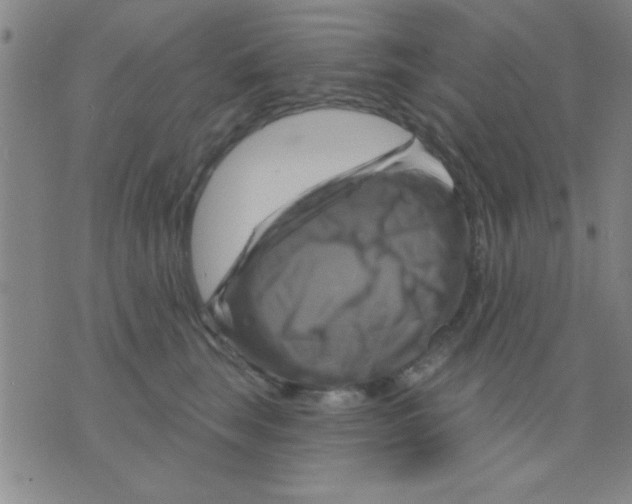 X0000075900663200610151817