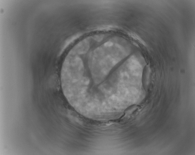 X0000075901256200610151807