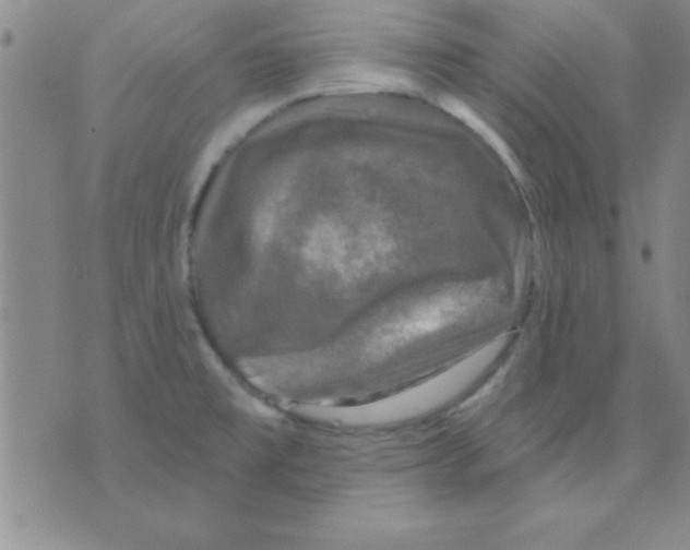 X0000075901477200610151804