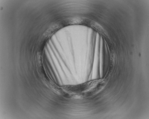 X0000075910366200610062148