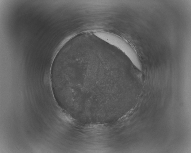 X0000075920147200609291833