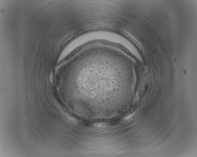 X0000075920117200610062217