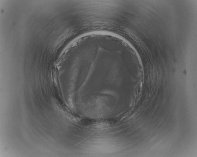 X0000075920696200610062208