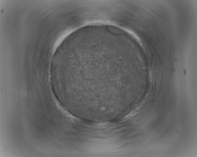 X0000075921279200610062158