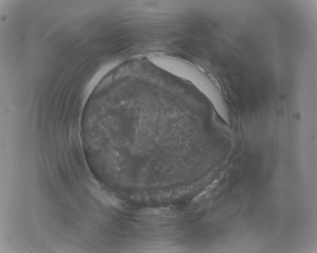 X0000075920147200610151915