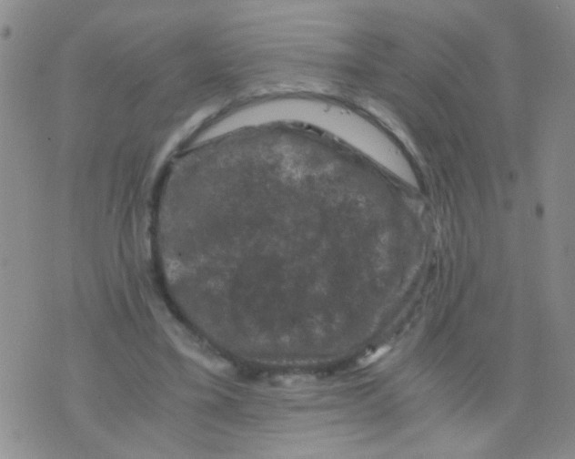 X0000075920395200610151911