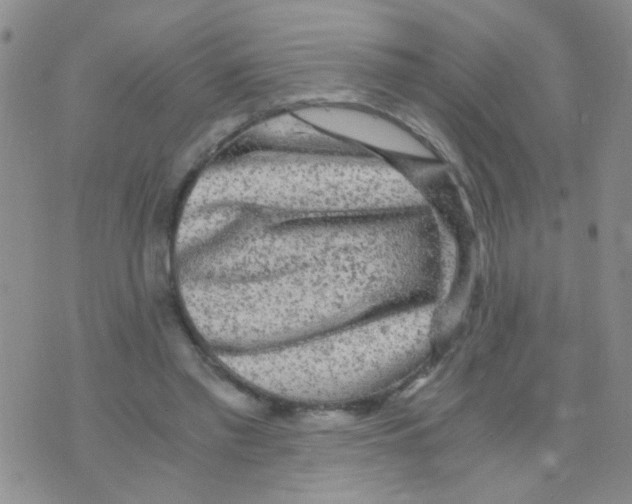 X0000075920397200610151911