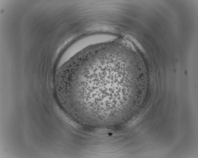 X0000075920399200610151911