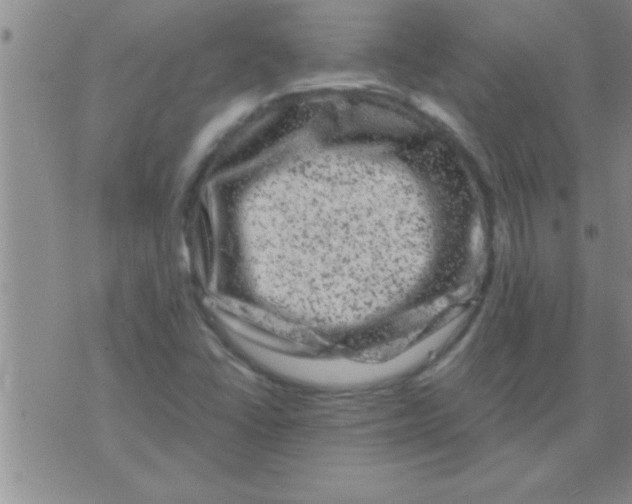 X0000075921406200610151855