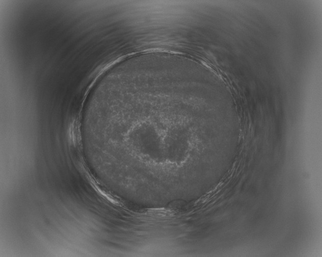 X0000076030050200610061428