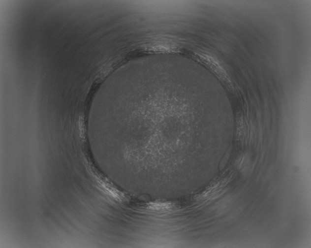 X0000076030457200610061422