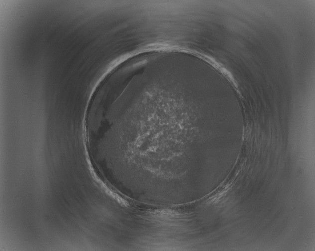 X0000076031239200610061410