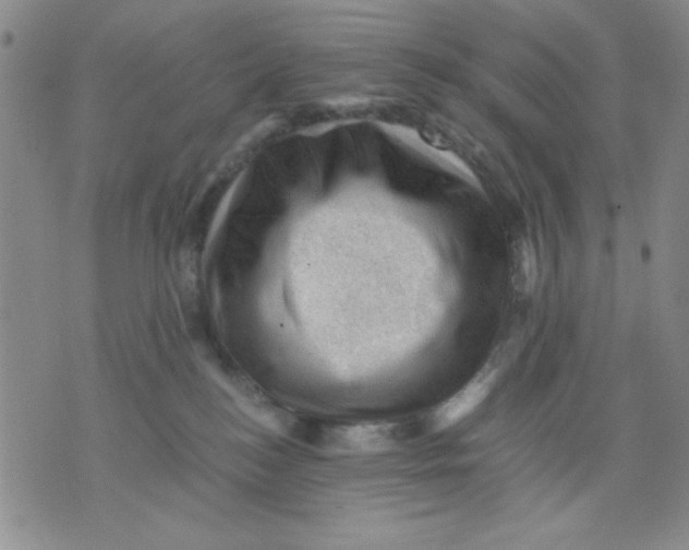 X0000076030184200610152056