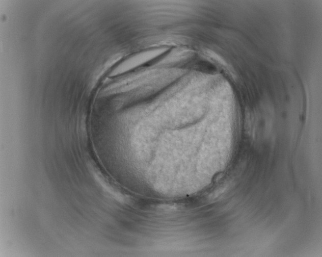 X0000076030394200610152052