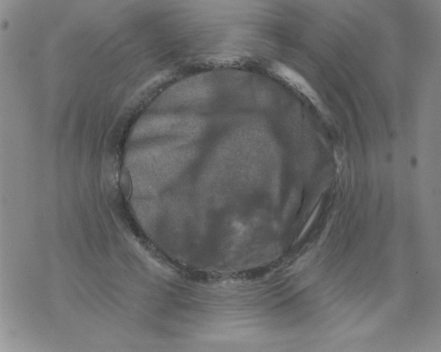 X0000076030593200610152049