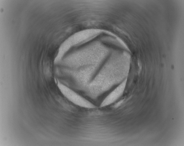 X0000076031250200610152038