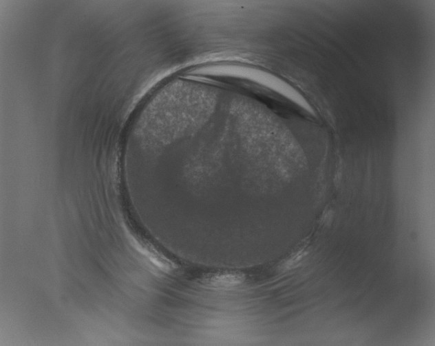 X0000076030156200610201836