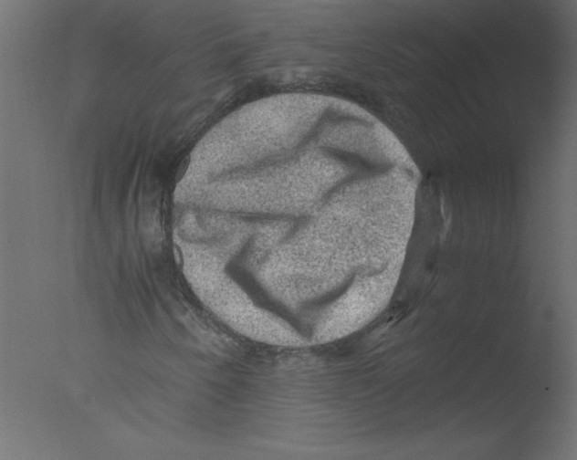 X0000076031250200610201818