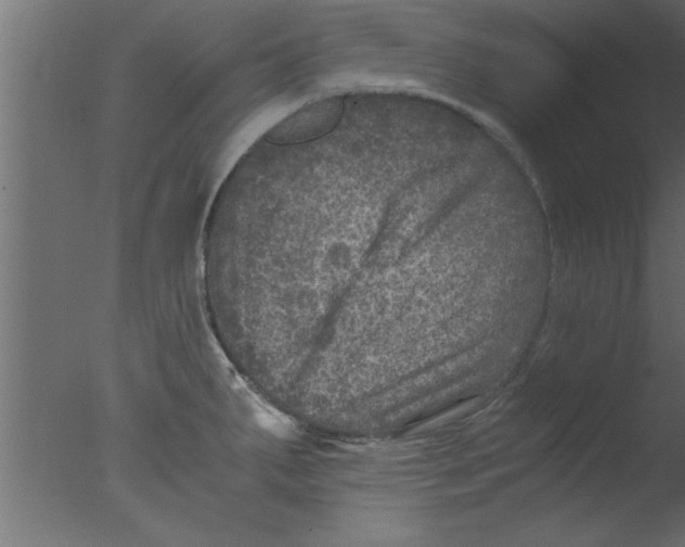 X0000076031287200610201817