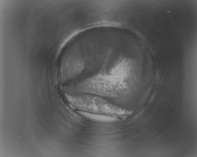 X0000076031310200610201817