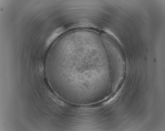 X0000076081065200610061610