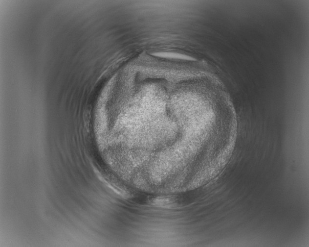 X0000076080171200610202049