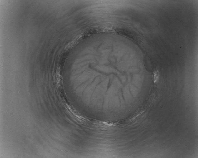 X0000076081011200610202034