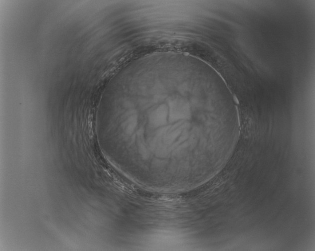 X0000076081013200610202034