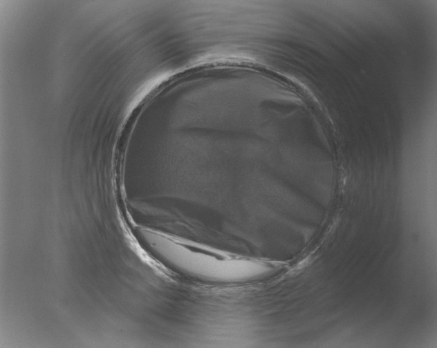 X0000076081038200610202035