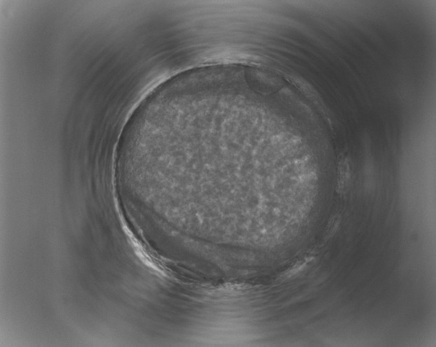 X0000076081039200610202035