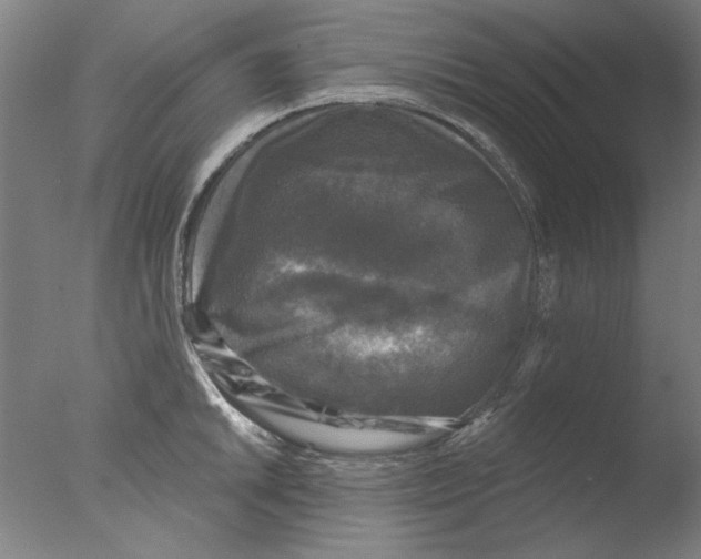 X0000076081046200610202035