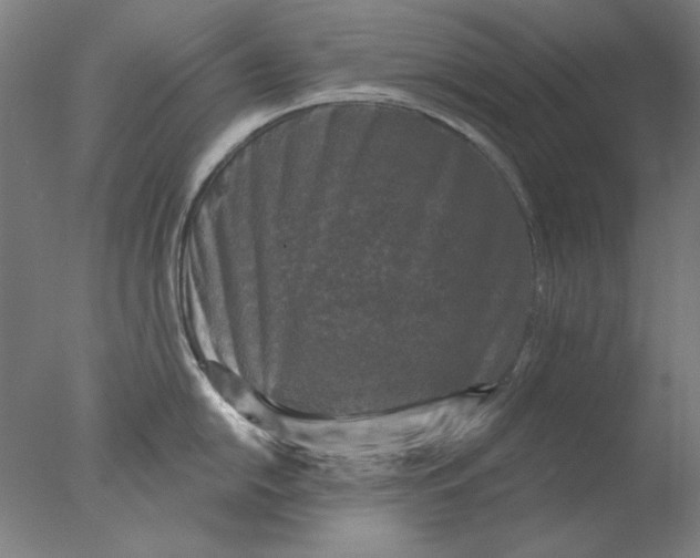 X0000076081054200610202035