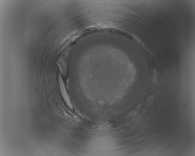 X0000076081110200610202033