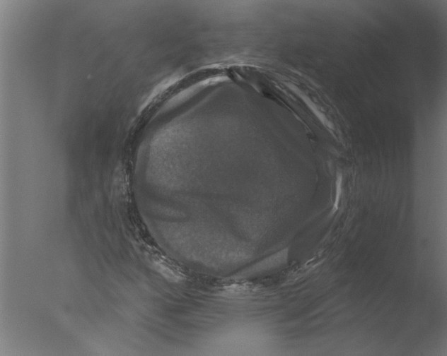 X0000076081160200610202033