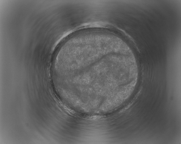 X0000076081166200610202033