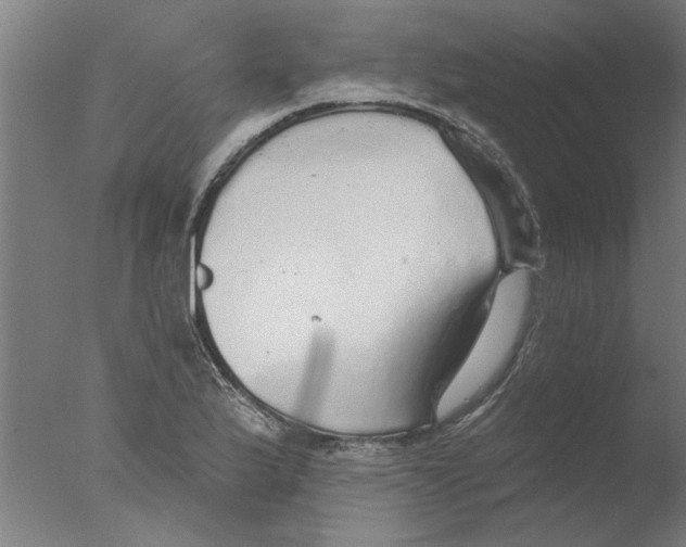 X0000076081175200610202032