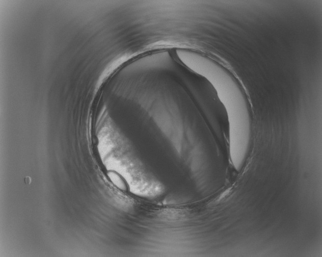 X0000076081179200610202032