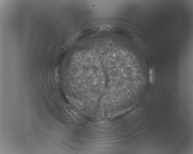 X0000076081395200610202028