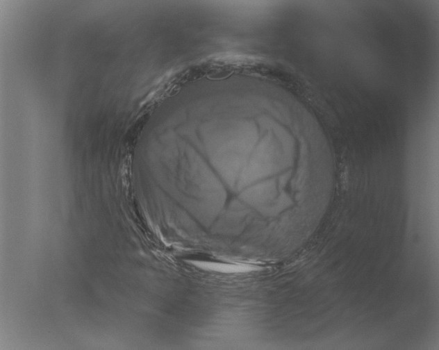 X0000076081397200610202028