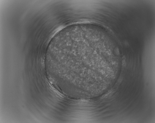 X0000076081409200610202028