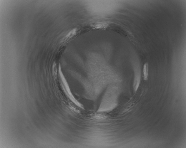 X0000076081443200610202028