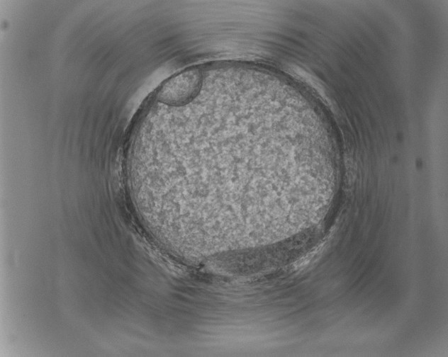 X0000076090875200610152316