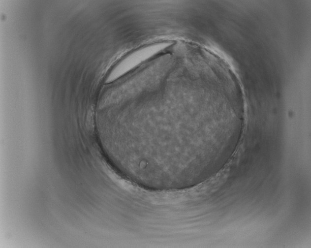 X0000076100009200610152355