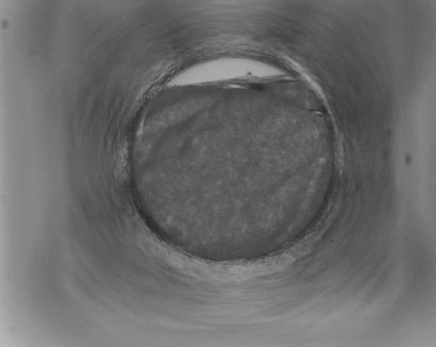 X0000076100018200610152355