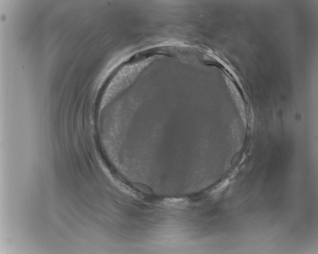 X0000076100055200610152353