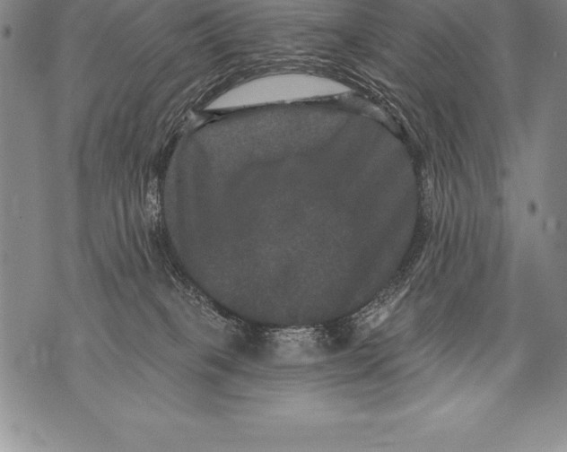 X0000076100085200610152354