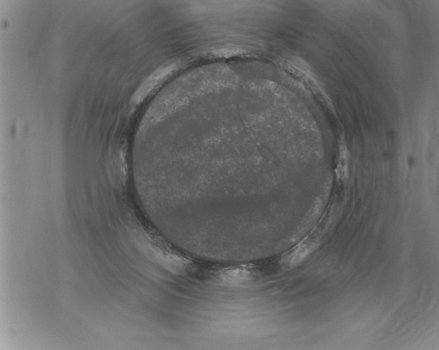 X0000076100116200610152353