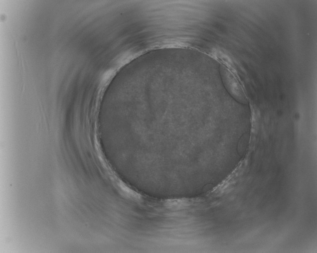 X0000076100145200610152352