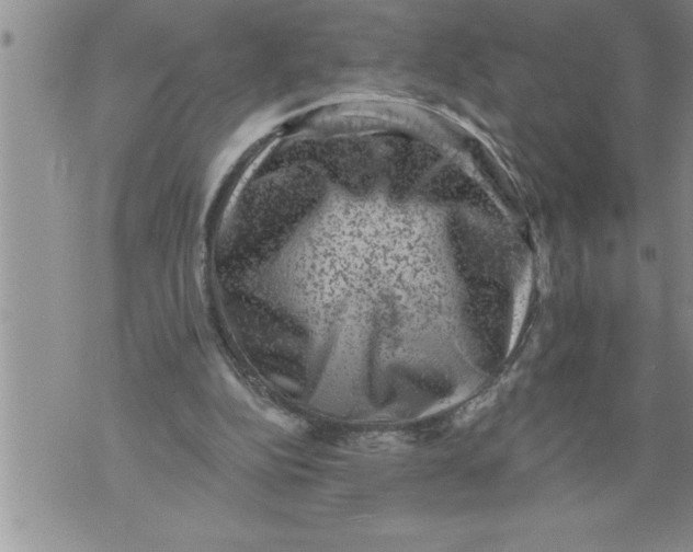 X0000076100152200610152352